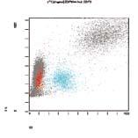 Keywords: Leukemia, hairy cell; Flow cytometry; Immunophenotypi ng; Antibodies, monoclonal e nos histogramas CD45 x SSC a região dessas células é tipicamente ao lado da região de linfócitos maduros