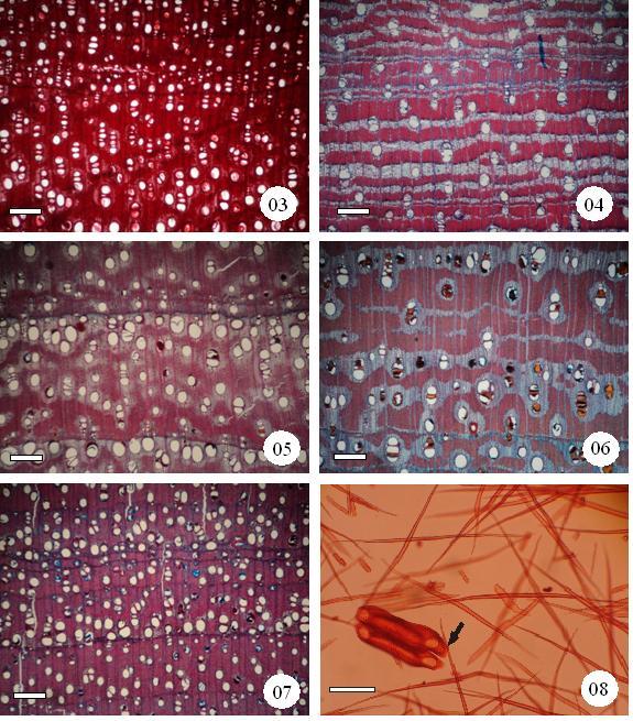 Figuras 3 a 8 Secção transversal e material dissociado das espécies de Caatinga. Figura 3 Secção transversal de Anadenathera colubrina. Figura 4 - Secção transversal de Mimosa cesalpiniifolia.