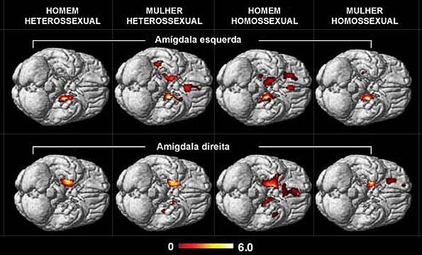 Homem gay tem cérebro feminino, comprova estudo A equipe de Ivanka Savic, do Instituto Karolinska analisou, tamanho,