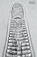 (filamentoso): Multiaxial c)