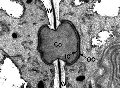 W: parede celular; Co: núcleo proteico; IC: fina camada interna do pit plug ;