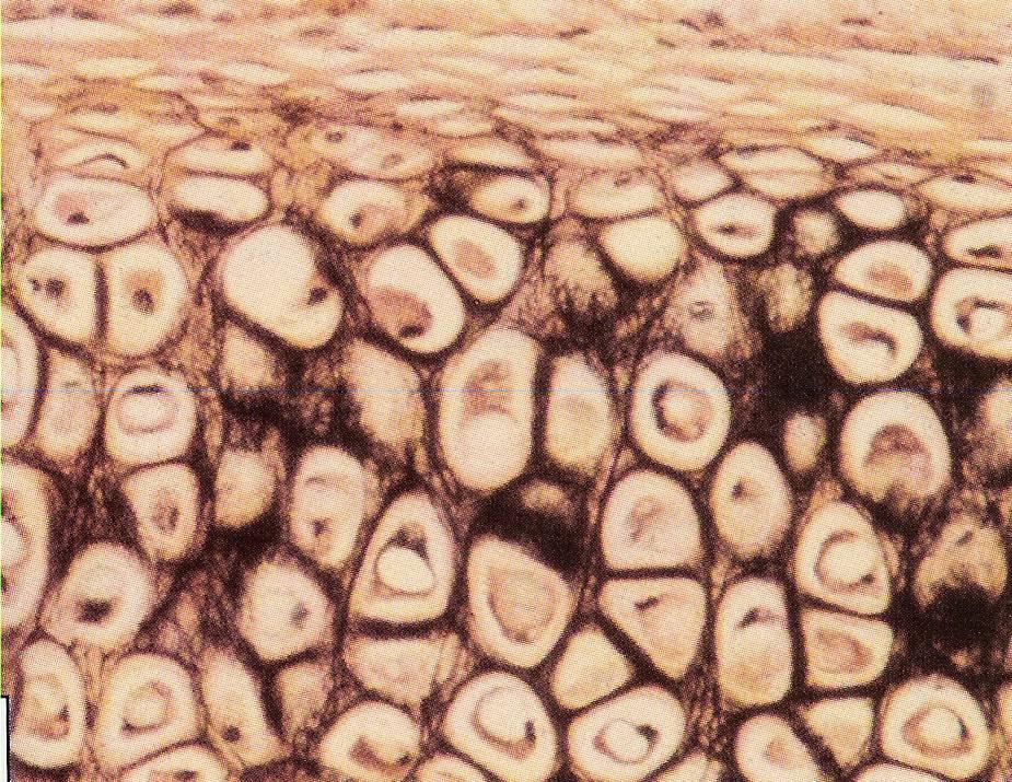 CARTILAGEM ELÁSTICA Características gerais: predominância de fibras elásticas na matriz Possui pericôndrio e também cresce principalmente por aposição (cresce pelo acúmulo de matéria orgânica em