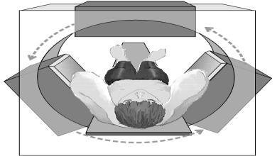 Em segundo lugar, ele é equipado com um computador que integra as múltiplas imagens para produzir uma visão seccional do órgão (Powsner e Powsner, 1998).