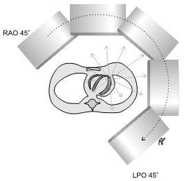 FIGURA 6 - As cinco imagens de projeções usadas em exame convencional de fígado e baço (Powsner e Powsner, 1998) 3.2.