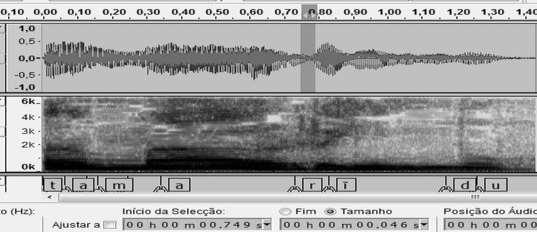 Figura 2- Oscilograma, espectrograma e camada de segmentação de fala de E2, no período pós-terapia.