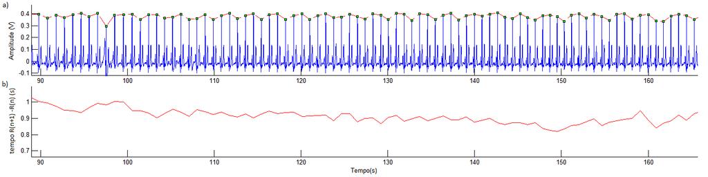 Tacograma RR Δtempo (ms) 1 821.