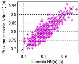 Poincaré plot SD2 SD1 a) desvio vertical (SD1), b) desvio longitudinal (SD2) c) razão SD1/SD2 d) área da