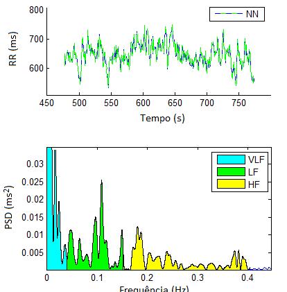 Transformada Rápida de Fourier Inibidor