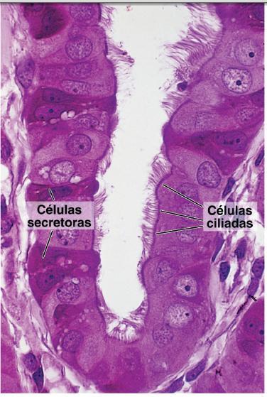 Epitélio colunar simples (ou pseudoestratificado), intermitentemente ciliado. -Células ciliadas Os cílios causam movimento sincronizado que encaminha o óvulo para o útero.