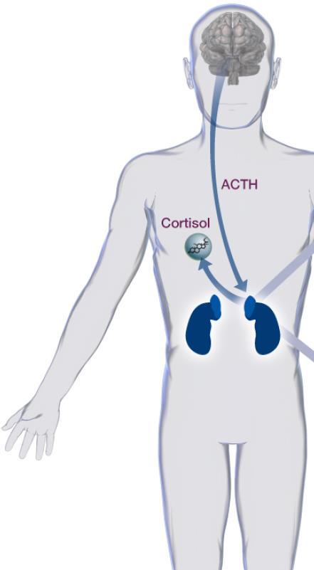 Recent advances in medical therapy Cabergoline Adrenal-directed agents Metyrapone Ketoconazole Mitotane LCI699 Mifepristone Pasireotide Indication Off-label Off-label Off-label In development