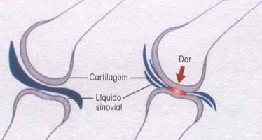 Tecido Conjuntivo Figurado Cartilaginoso Características O tecido cartilaginoso