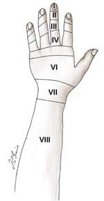 Mecanismo Extensor da Mão: Desvendando a Anatomia e Avaliação por Métodos de Imagem V Figura Zonas do antebraço.