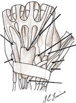 Articulação interfalangiana proximal; IV. Falange proximal; V. Articulação metacarpofalangiana; VI. Dorso da mão; VII. Compartimento extensor do punho; VIII. Músculos extensores extrínsecos.