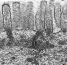 Os filamentos de actina formam um cinto àvolta das células ligando as umas às outras.