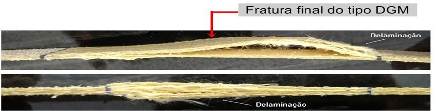 Figura 5 Característica da fratura do laminado LCMH/RP. Figura 6 Característica da fratura do laminado LCMH/RE (5).