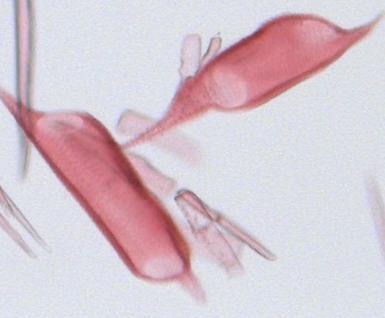 contortisiliquum. A: Secção transversal do lenho em macroscopia.