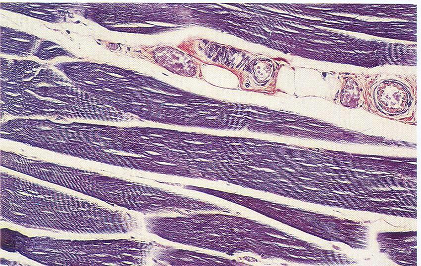 Fibras da neuróglia Núcleos Centríolos Mitocôndrias Fibrina Eritrócitos Estrias musculares