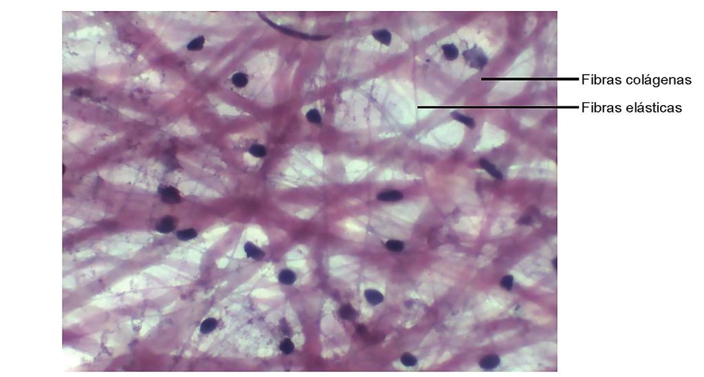 Figura 5. Fibras colágenas e elásticas do tecido conjuntivo (Preparado total de mesentério em aumento grande) Fonte: ATLAS DIGITAL DE HISTOLOGIA BÁSICA Fibras Reticulares As fibras reticulares (Fig.