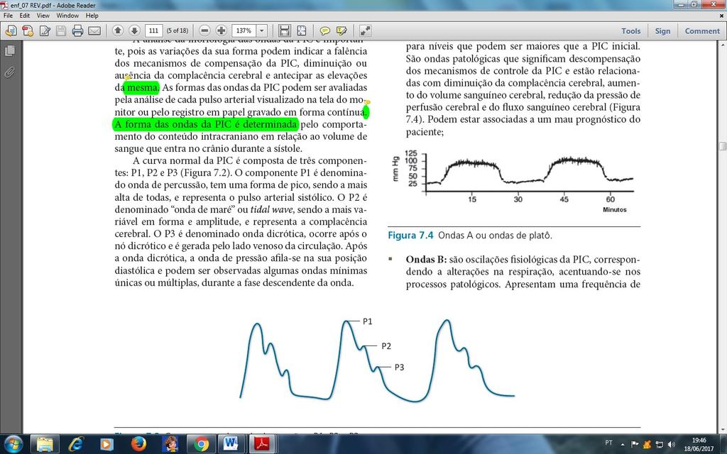 Página: 4/6 OBSERVAÇÕES A passagem do cateter de pressão intracraniana deve ser realizada preferencialmente no centro-cirúrgico.