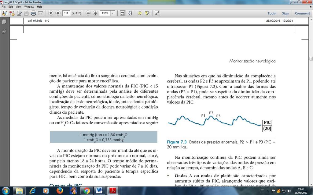 Página: 5/6 Curva anormal de PIC, onde P2 > P1 indicando baixa complacência cerebral.