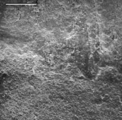 FIGURA 3 - Micrografia de varredura da junção sistema adesivo/resina/dentina tratada com laser Er:YAG.