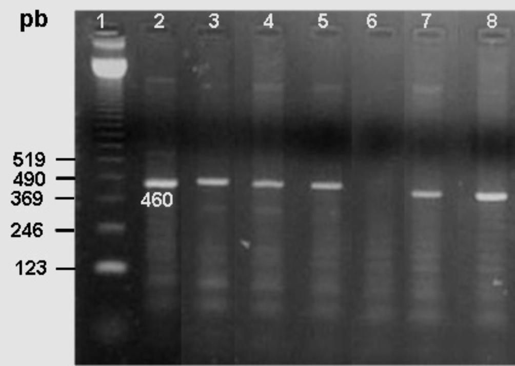 Ocorrência e caracterização molecular de espécies de Babesia em cães de uma população hospitalar da região de Londrina, PR 279 foi calculado através do programa Epi-Info 6,04b, tendo como universo