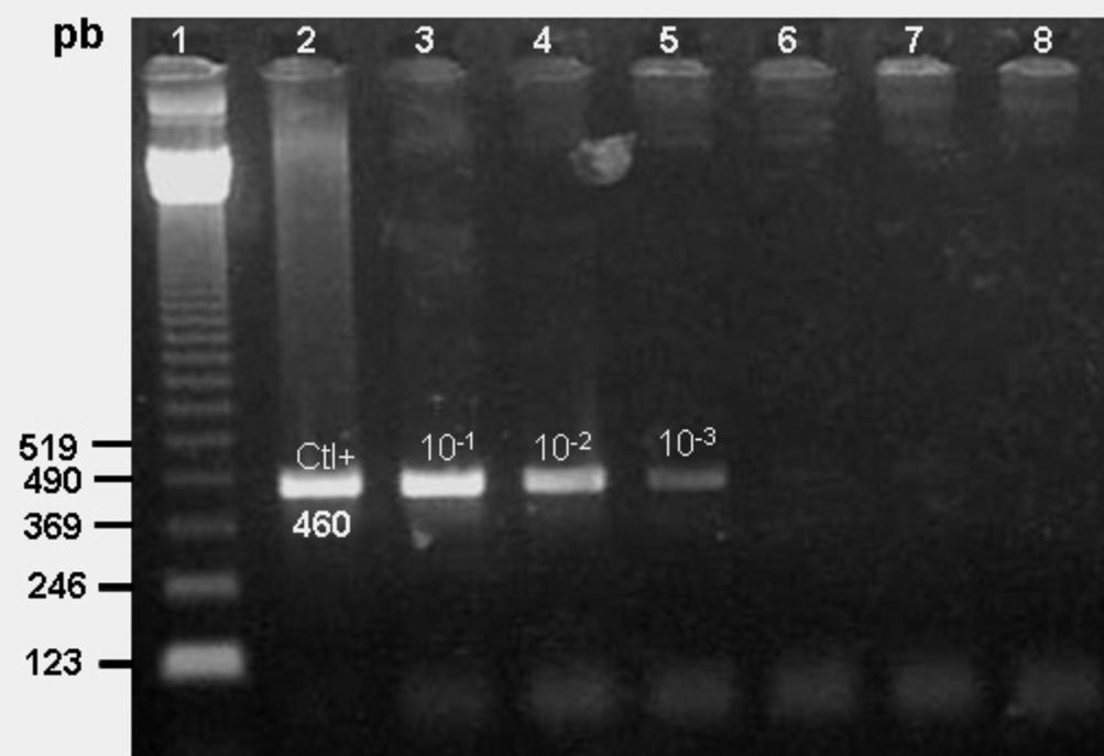 280 Jojima et al. Tabela 1. Percentagem de amostras positivas para as espécies de Babesia obtidas pela PCR e PCR-RFLP em cães. Nº de PCR Clivagem Amostras Positivo Negativo B. canis vogeli B.