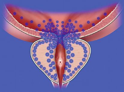 alfa1-adrenérgicos responsáveis pelo tónus muscular liso dentro da próstata e uretra, e do colo vesical.