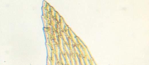 B A C Figura 17. Clastobryum papillosum R.S.