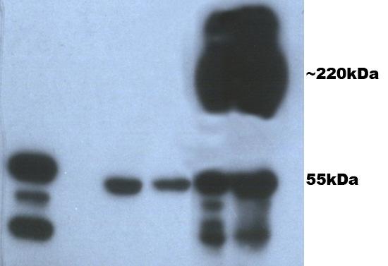 1 2 3 4 5 6 Figura 2 Expressão de Gag por células HEK-293 transfectadas com os plasmídeos pitrgag e pitr-lamp/gag.