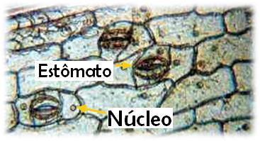 GLOSSÁRIO ²Núcleo celular: Esta é a vista de Brown obtida em 1828, quando ele reconheceu o núcleo da célula. O núcleo pode ser visto claramente dentro de cada célula.