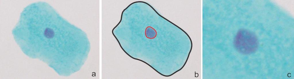 25 A figura 2 representa uma imagem da célula da mucosa bucal sem a presença de MNi.