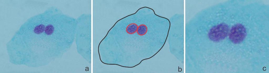 Desta forma, os micronúcleos podem ser biomarcadores de instabilidade cromossômica associada à exposição a agrotóxicos.