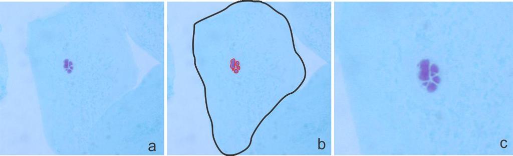 27 Cariorrexe Figura 7 - (a) Imagem da célula da mucosa bucal em cariorrexe de indivíduo do grupo exposto; (b) citoplasma e núcleo em cariorrexe em