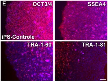 Expressão de marcadores de pluripotencialidade em