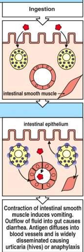 ALERGIA ALIMENTAR Ingestão e absorção do Ag peristalse, secreção e extravasamento de