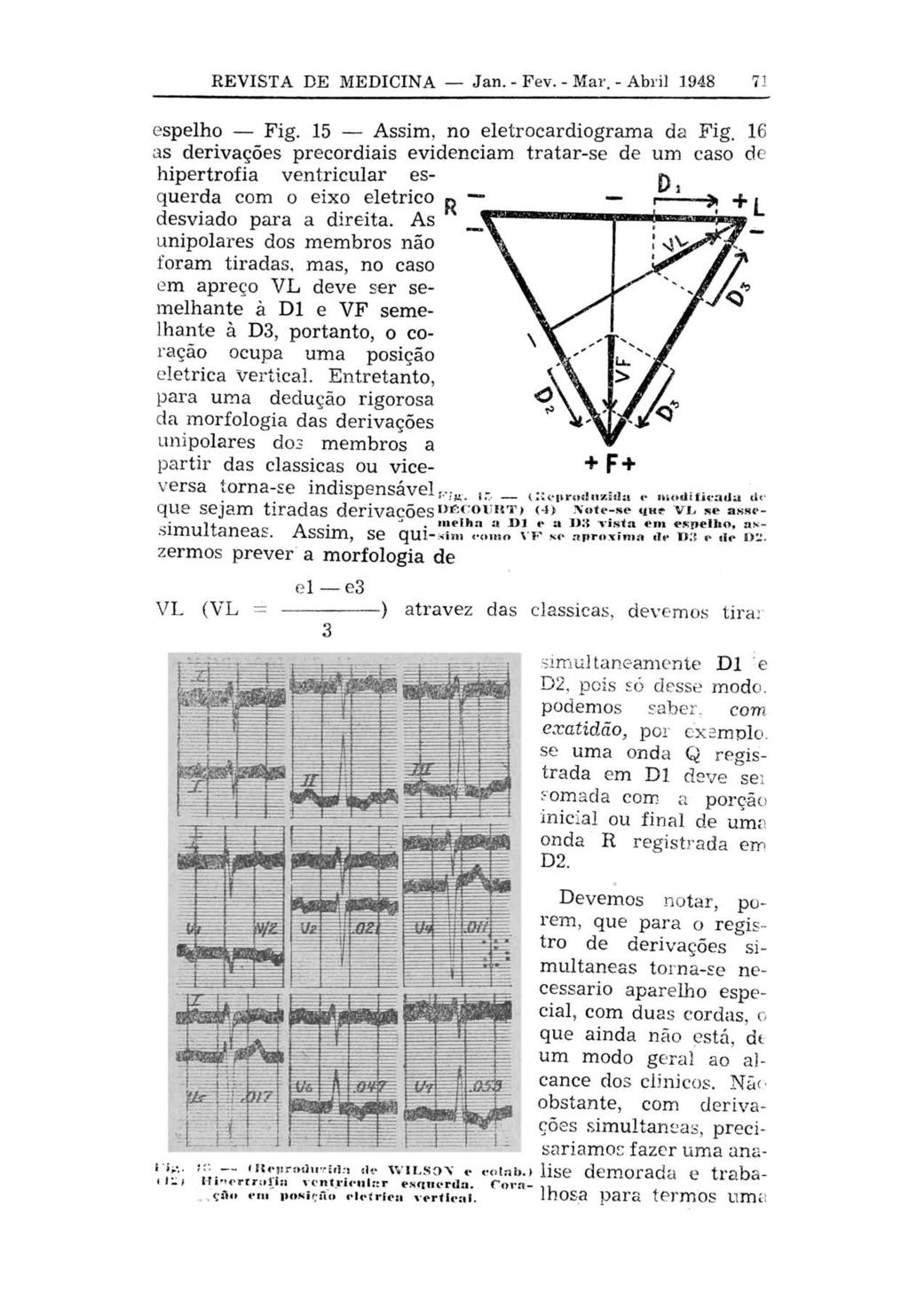 REVISTA DE MEDICINA Jan. - Fev. - Mar. - Abril 1948 71 espelho Fig. 15 Assim, no eletrocardiograma da Fig.