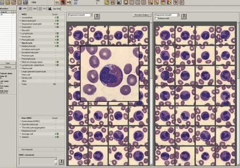 Processo integrado projetado para o seu fluxo de trabalho Informação integrada O DI-60 permite que o analista detecte qualquer anormalidade nas várias telas de visualização, proporcionando uma rápida