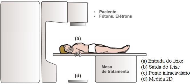 Figura 2.2. Características da teleterapia e diferenças entre o tratamento convencional e a teleterapia com intensidade modulada.