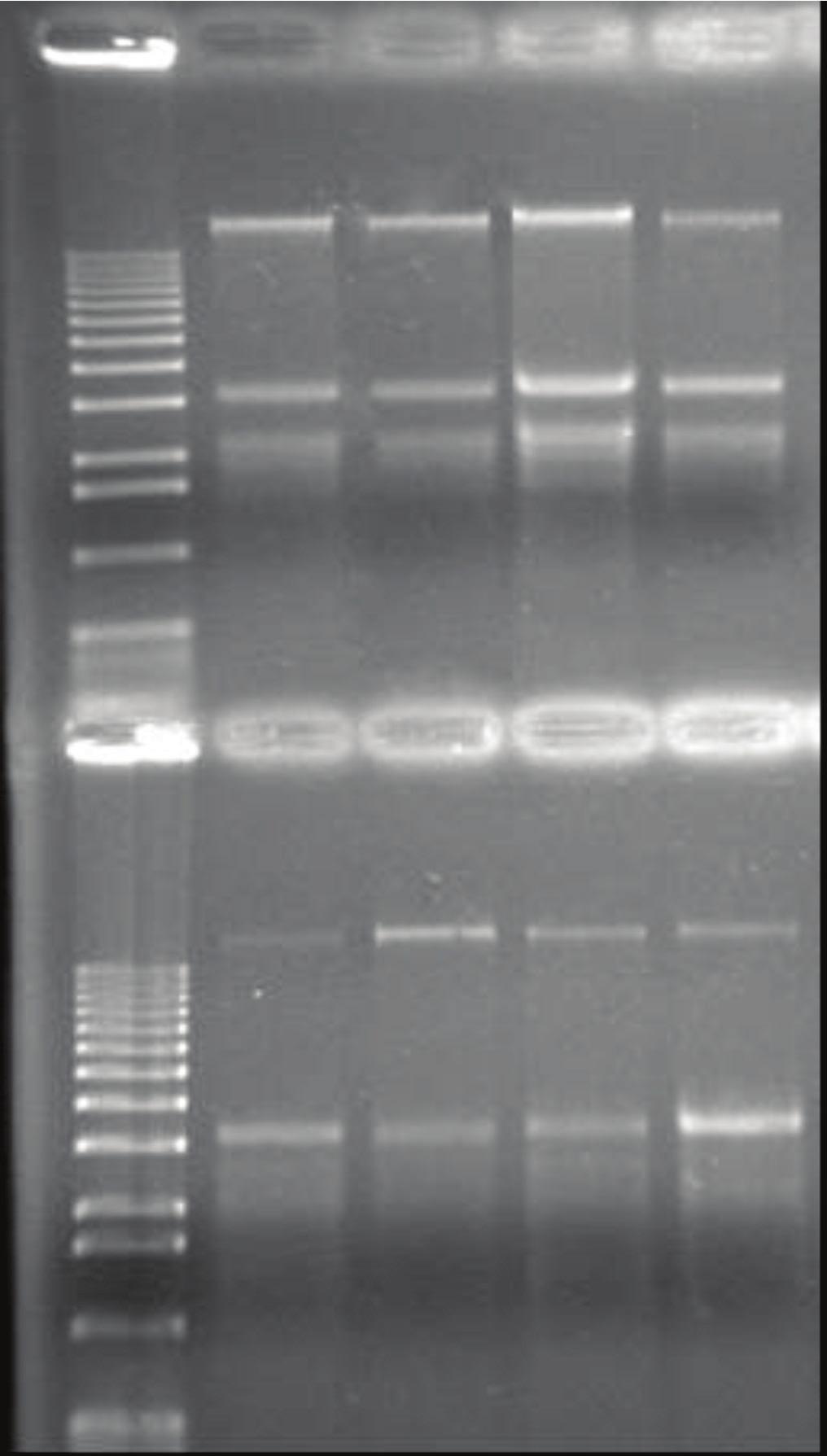 6 Protocolo de deficiência hídrica em arroz de terras altas para análise de transcriptoma Tabela 2.