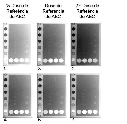 com o sistema convencional e com o sistema digital foram colocadas em um negatoscópio de alta luminosidade e analisadas.