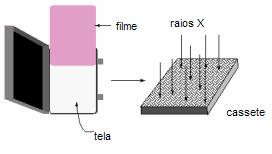 O filme fotográfico é então, o registro e dispositivo de apresentação da imagem e, ainda, a forma de registro para arquivo do exame de mamografia (Figura II.8). Figura II.