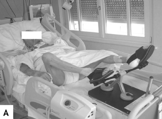 Treinamento físico em pacientes traqueostomizados, cronicamente ventilados Clini EM et