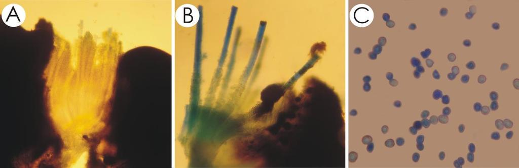 132 NOTA TÉCNICA Figura 2. (A e B) Corte dos soros mostrando feixes de hifas e esporos. (C) Esporos de Graphiola phoenicis (aumento de 100x).
