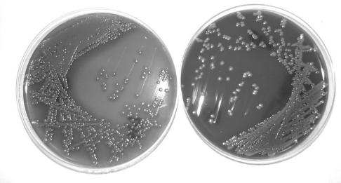 Escherichia Escherichia coli urina, MacConkey e gelose de sangue urina, Gram E.