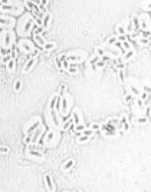 coloração capsula Klebsiella - doença pneumonia