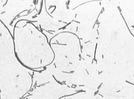 'Priority Pathogens' for R&D