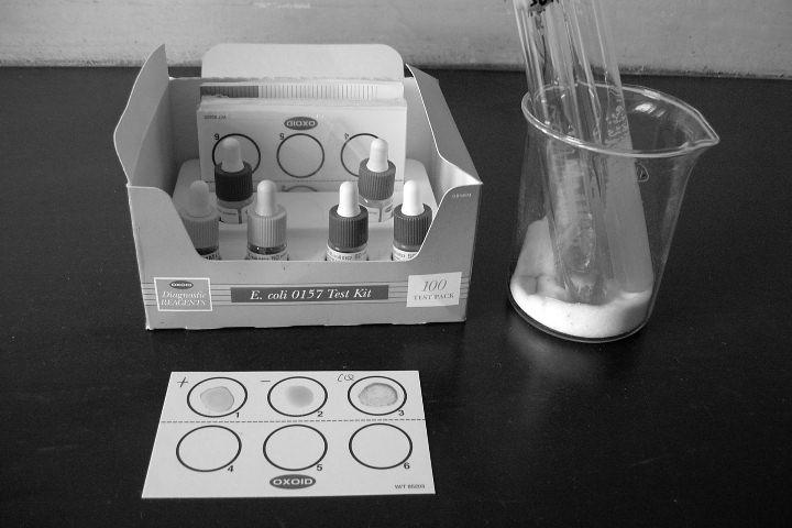 Antigénios - importancia aglutinação das bacterias serve para diagnóstico e epidemiologia três exemplos: 1) Escherichia coli K1 meningite neonatal 2) Escherichia