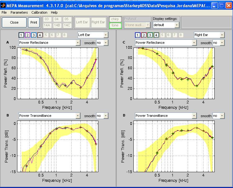 Figura 8 Exemplo de exame de RE, em condição normal de orelha média, com estímulo chirp (linhas contínuas) e tons puros (asterisco) O sistema MEPA3 utilizado no presente