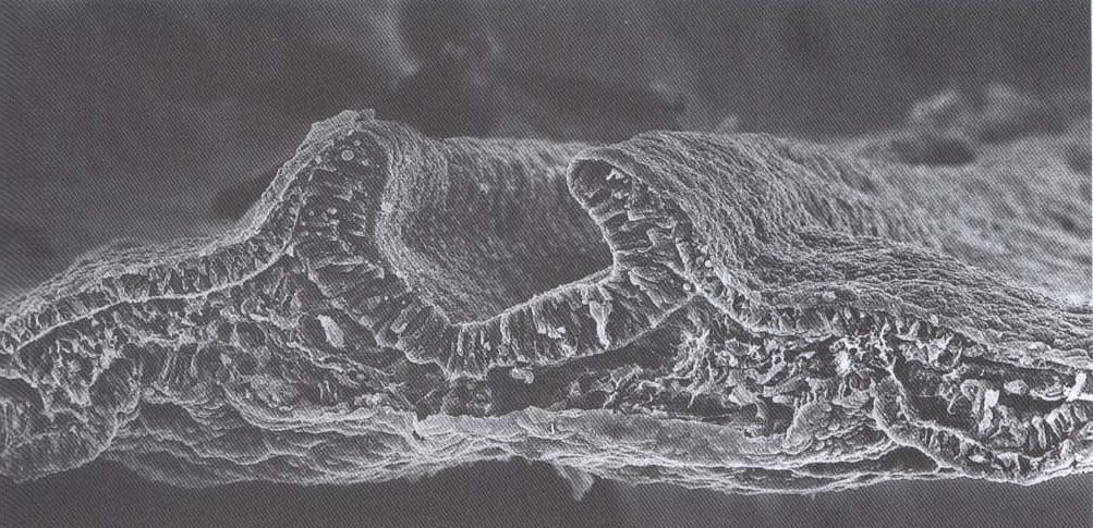 Filamentos de actina no desenvolvimento embrionário Actina nuclear Envolvida na regulação da